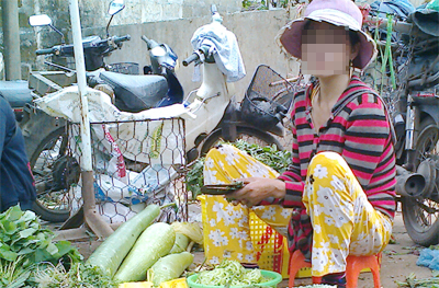 Cuộc sống cơ cực của người vợ nhiễm “H” từ chồng 
